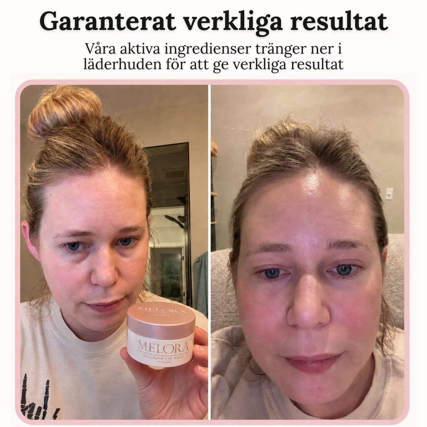 Lash Lift Øjenvippebukker